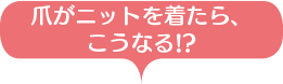 爪がニットを着たら、こうなる!?